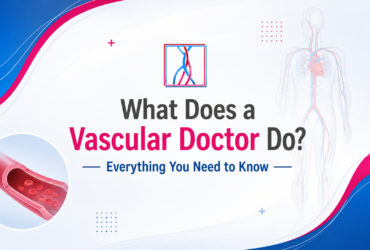 What Does a Vascular Doctor Do_ Everything You Need to Know _ Complete Guide